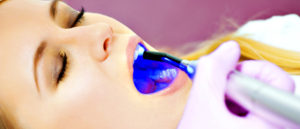 Tratamientos odontologia estetica Clínica Dents